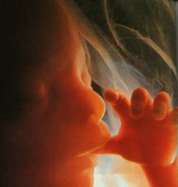 انواع و روش های سقط جنین